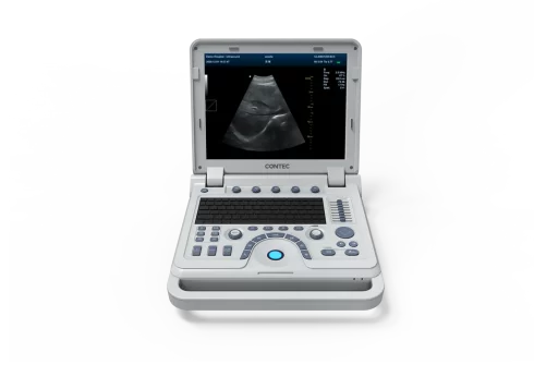 CONTEC CMS600P2PLUS B-ultrasound scanner